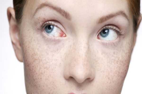 怎么区分斑和痣