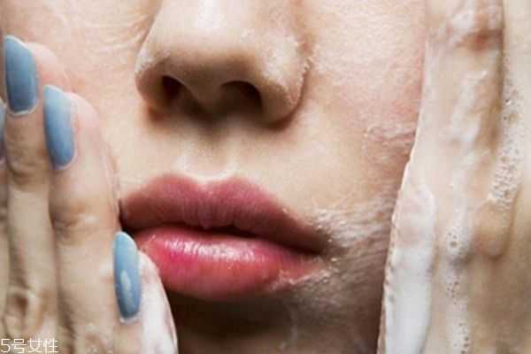 干皮为什么还长痘