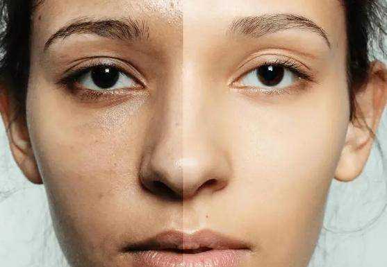 “长期化妆”和“长期素颜”，5年后皮肤有什么区别？