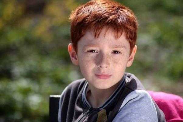 雀斑会变成黄褐斑吗?雀斑会一直长吗 雀斑会变成黄褐斑吗?雀斑会一直长吗