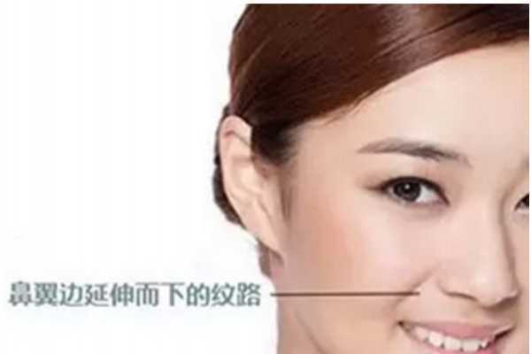 法令纹在什么位置 法令纹在什么位置