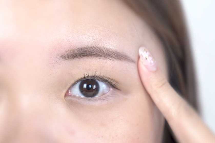 如何快速消除眼部浮肿