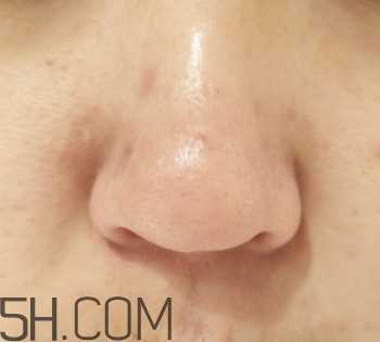 御泥坊鼻膜怎么样？御泥坊鼻膜好用吗？