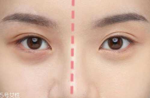 眼下遮瑕卡粉怎么办