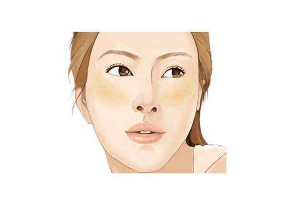 黄褐斑与抽烟喝酒有没有关系 黄褐斑与抽烟喝酒有没有关系