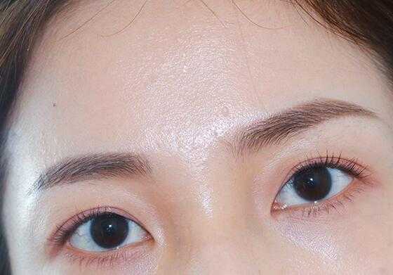 夏天为什么脸上老是会出油 面部出油多原因 夏天为什么脸上老是会出油 面部出油多原因