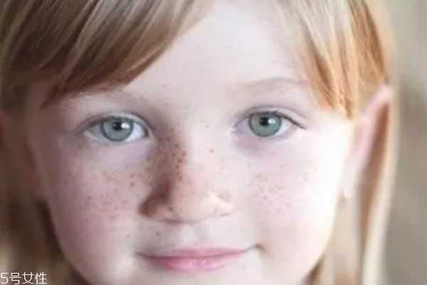 色斑的形成原因和去除方法