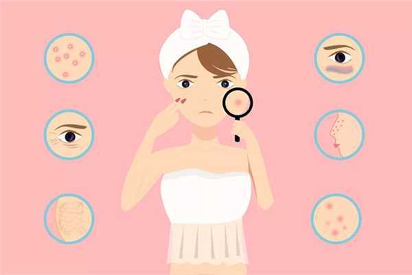 闭口和粉刺的区别 闭口和粉刺是一样的吗