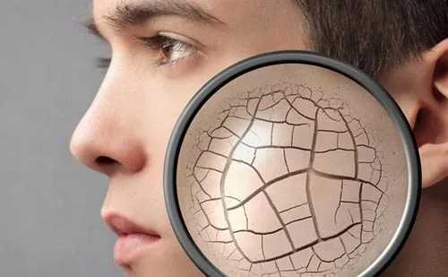 啫喱卸妆适合油性皮肤么 啫喱卸妆适合油性皮肤么