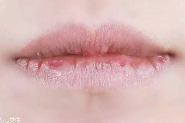 嘴唇为什么干燥