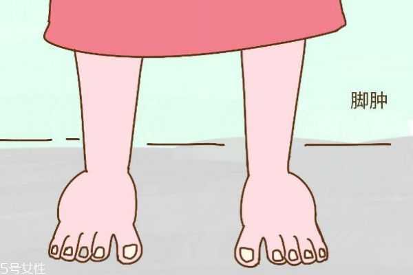 人为什么会水肿呢