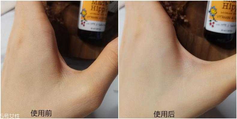 mad hippie维a精华适合什么肤质