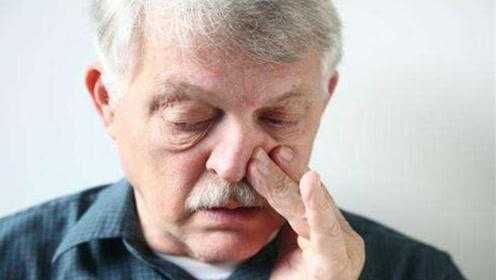 鼻毛为什么会变白?可能是以下几个原因 鼻毛为什么会变白?可能是以下几个原因