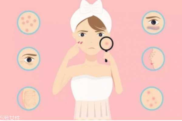 什么皮肤需要去角质 深层清洁不是所有人都适合