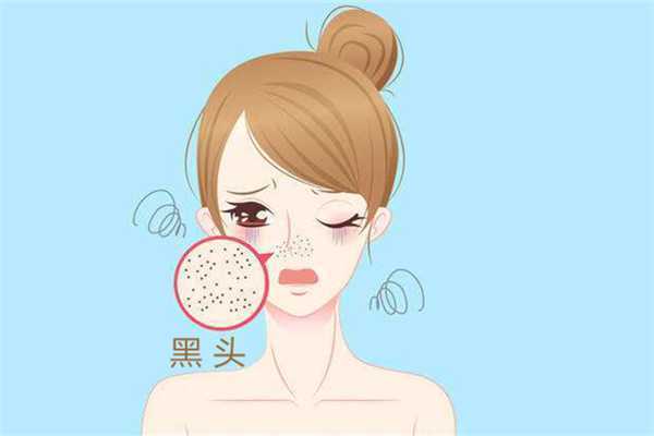 黑头是怎么产生的?黑头可以挤吗 黑头是怎么产生的?黑头可以挤吗
