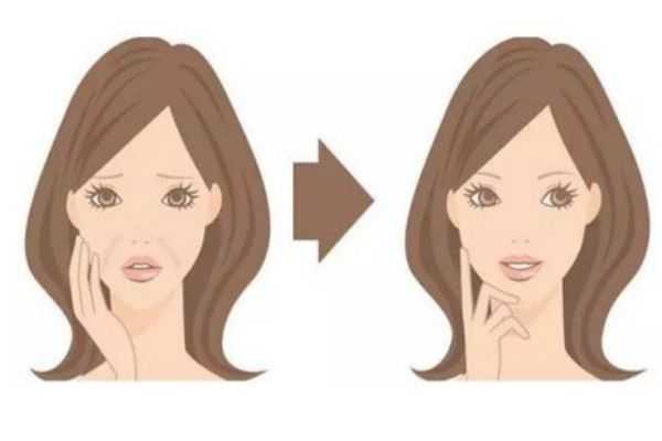 什么是法令纹 法令纹消除方法有什么呢