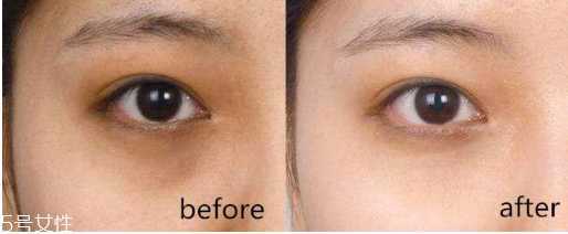 眼霜什么成分能去黑眼圈？眼霜淡化黑眼圈多久见效