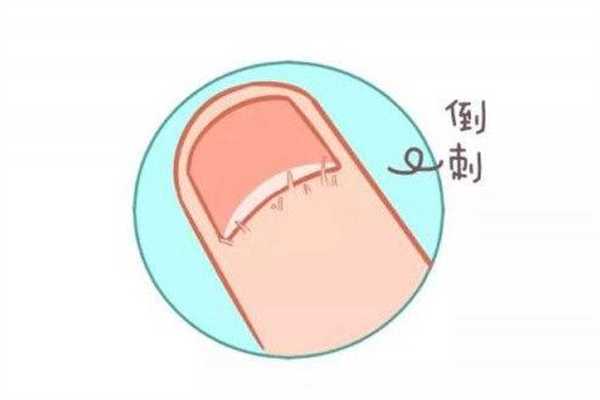 手长倒刺涂护手霜有用吗