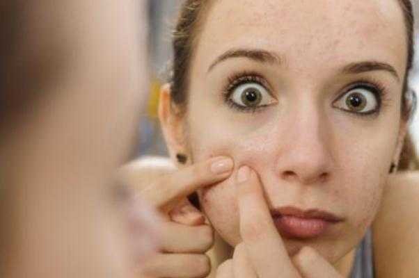 粉刺可以挑出来吗？粉刺可以自己挤吗