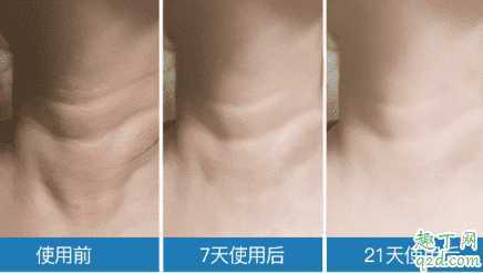 米加颈霜有没有效果