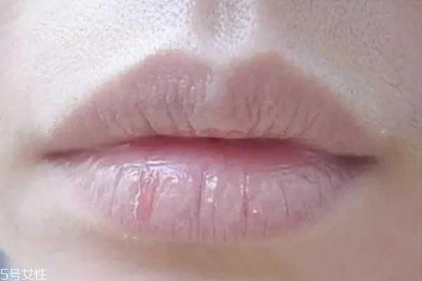 嘴唇为什么干燥
