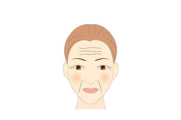 抬头纹可以打肉毒素吗 抬头纹可以打肉毒素吗