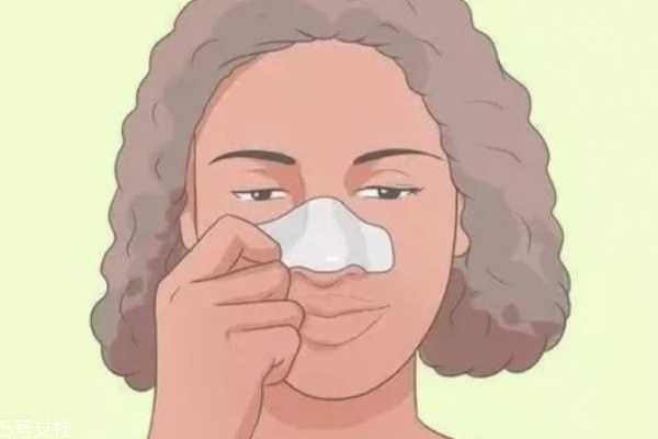 粉刺黑头怎么去