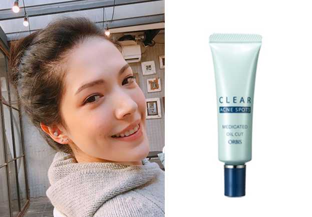 哪款抗痘精华厉害