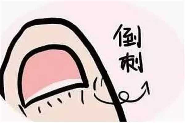 手长倒刺涂护手霜有用吗