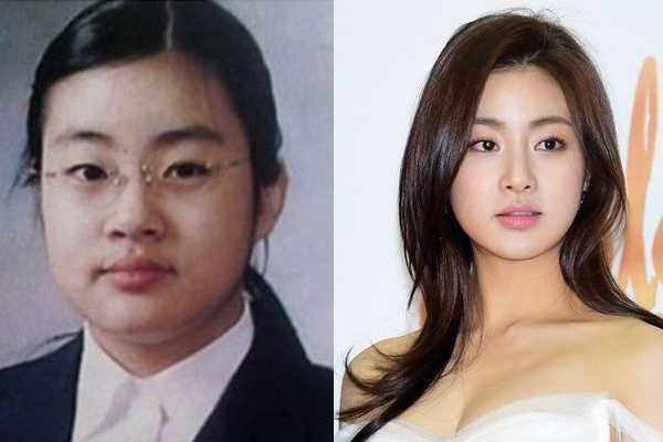 脸上水肿怎么消除最快