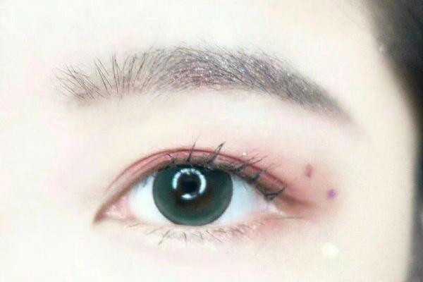 美瞳对眼睛的伤害到底有多大?怎么避免美瞳的危害