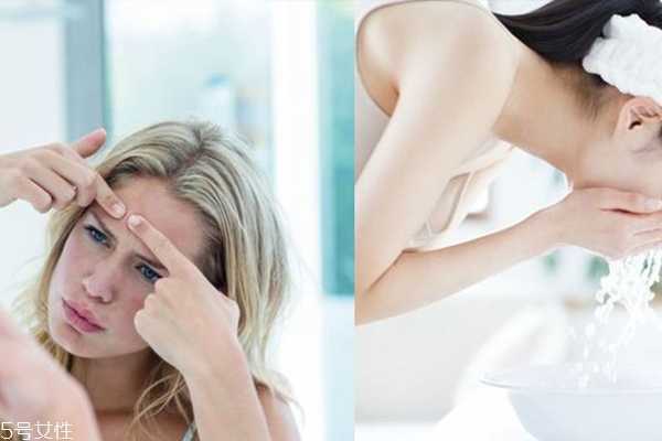 挤痘痘工具用什么好