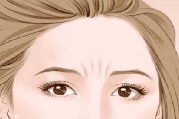 川字纹怎么消除 川字纹是什么