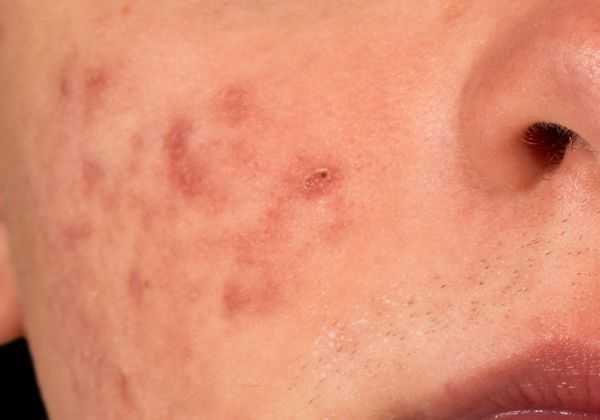 珍珠粉的功效有哪些 珍珠粉的功效有哪些