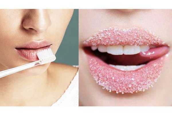 唇周黑色素怎么去除