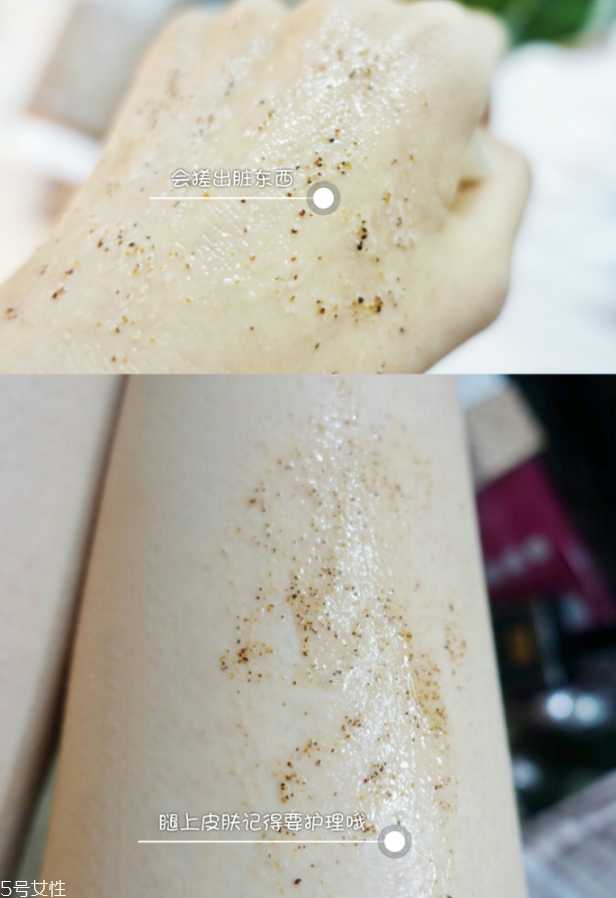 去鸡皮肤用什么好