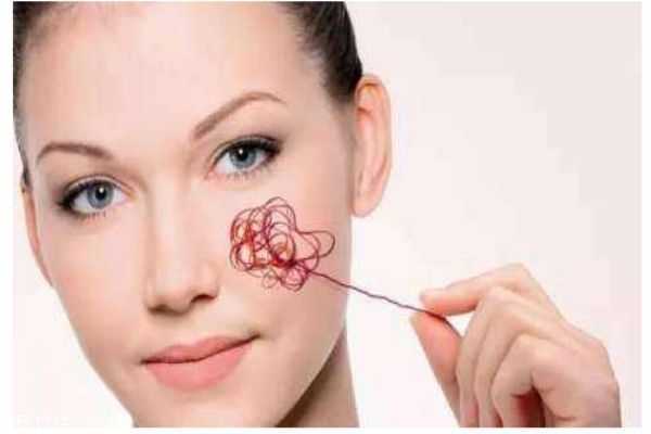 为什么脸上容易有红血丝