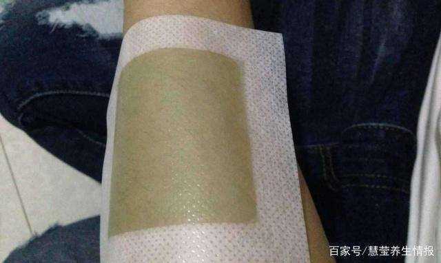 为什么有些女生汗毛多过男人？通常是3个原因导致的，不妨了解下 