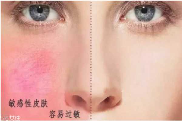 怎么判断自己什么肤质 油皮应该如何护肤