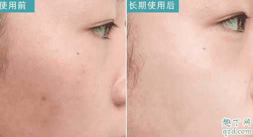 D18净透修护精华液好用吗 D18净透修护精华液好用吗