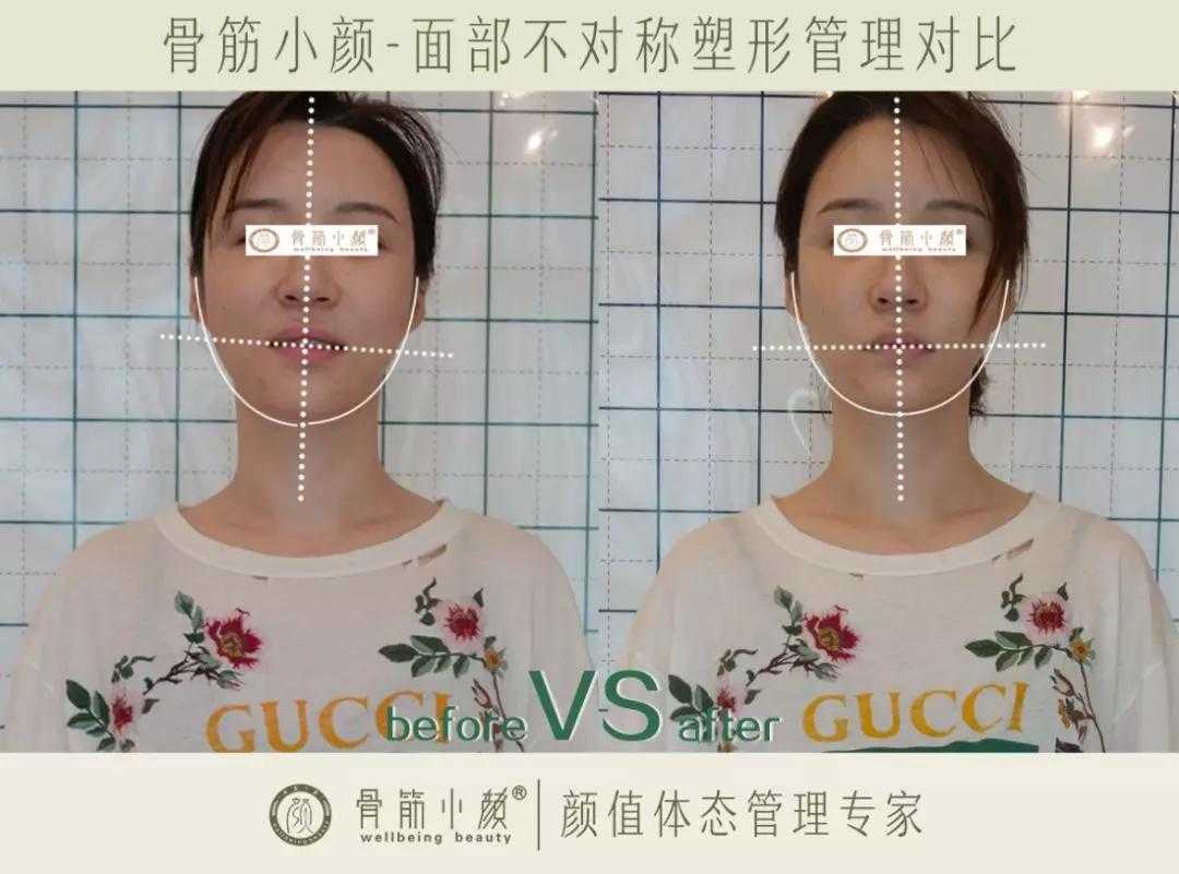 日式小颜都有哪些内容? 日式小颜都有哪些内容?