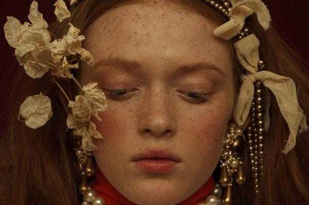 雀斑对身体有影响吗 雀斑可以做光子嫩肤吗