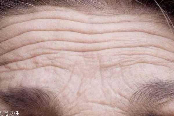 什么是抬头纹呢