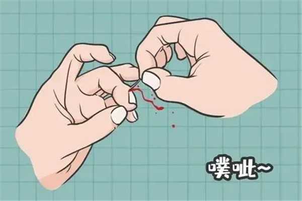 倒刺可以撕吗？倒刺拔了会怎么样？千万不能任性直接撕掉