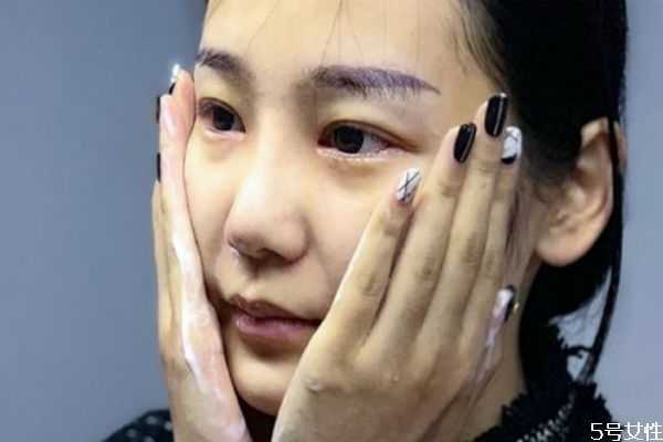 青春期皮肤变差怎么办？青春期应该怎么护肤