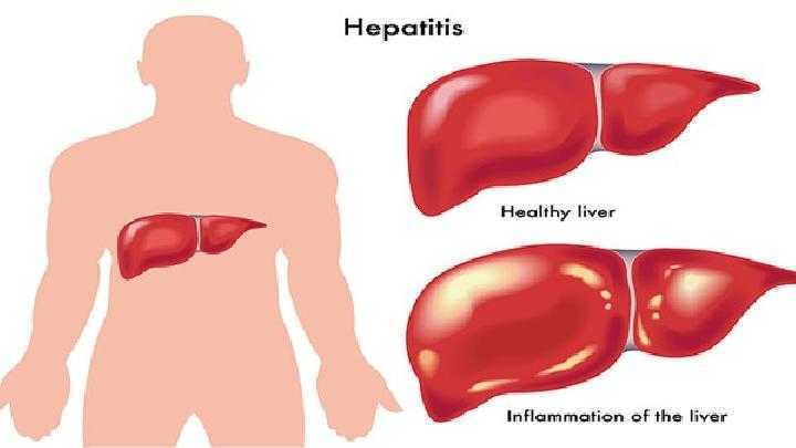 脸与内脏有关系吗?痘痘的位置反应病根