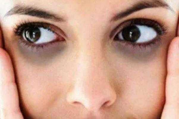 眼袋为什么有脂肪粒 眼袋为什么一个大一个小