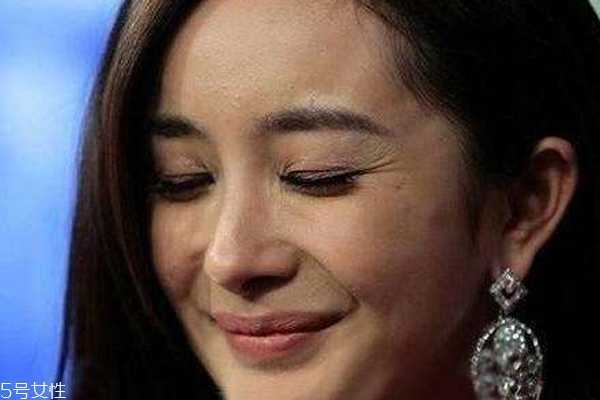 额头大量冒痘什么原因 绿豆红枣莲藕能泻火