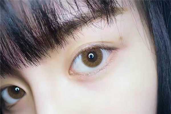 美瞳过期了还能继续戴吗 美瞳过期了还能继续戴吗