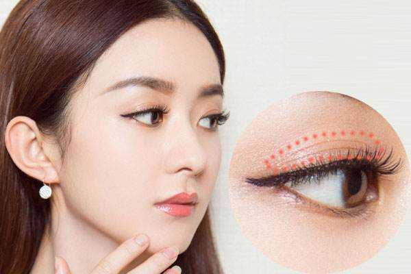 长期贴双眼皮贴有什么危害?双眼皮贴有几种类型 长期贴双眼皮贴有什么危害?双眼皮贴有几种类型